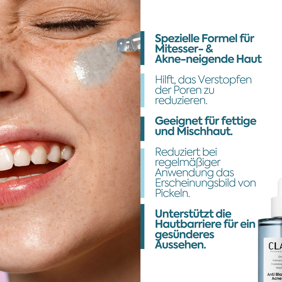 Clasy Care Anti-Mitesser & Akne Serum – 50 ml