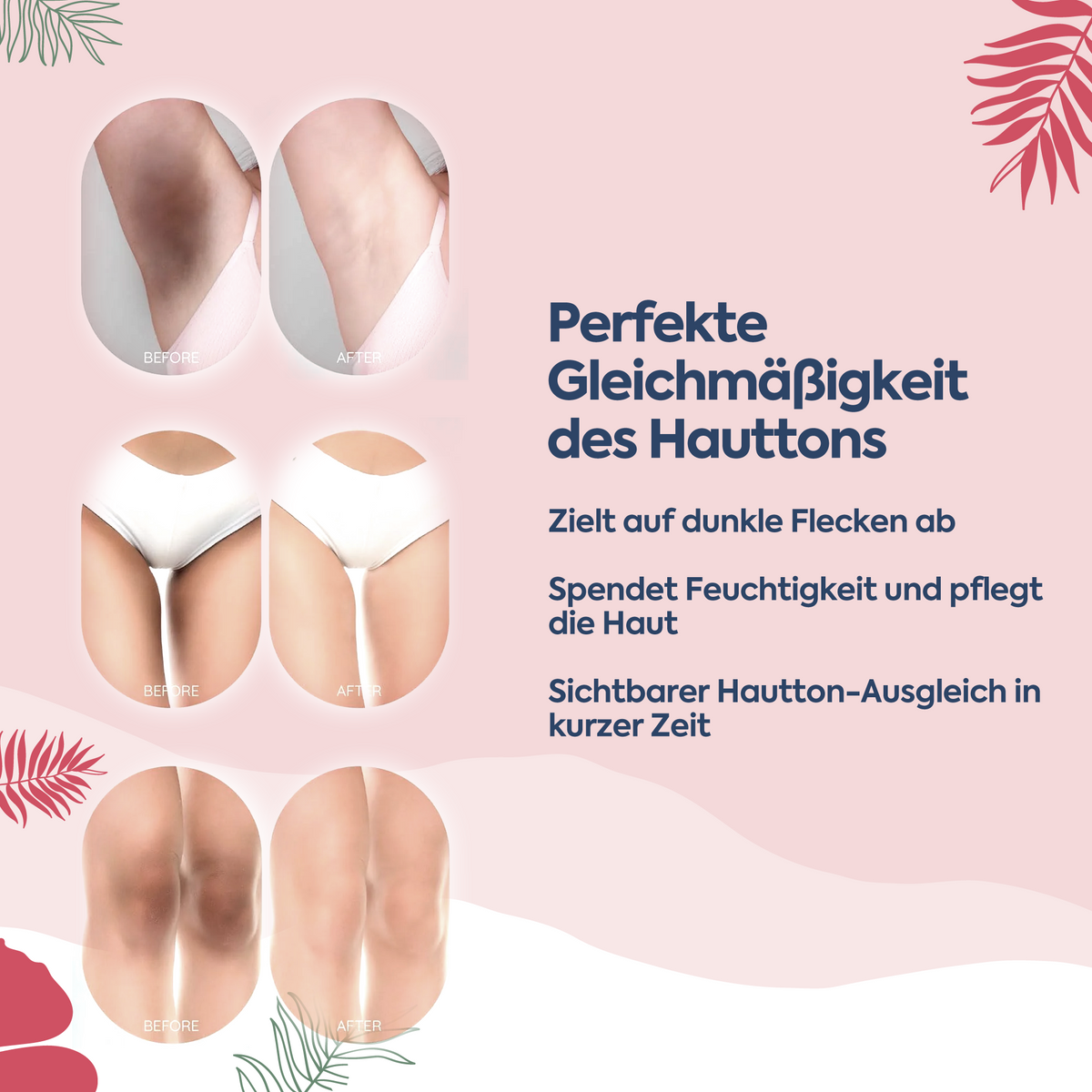 Clasy Care Anti-Flecken & Hautton-Ausgleichende Albanische Formel – Pigment Korrektur Creme 100 ml
