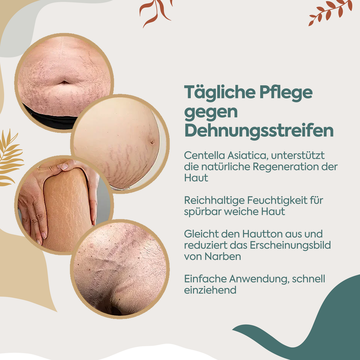 Clasy Care Perfekte Regeneration gegen Narben & Dehnungsstreifen – 100 ml