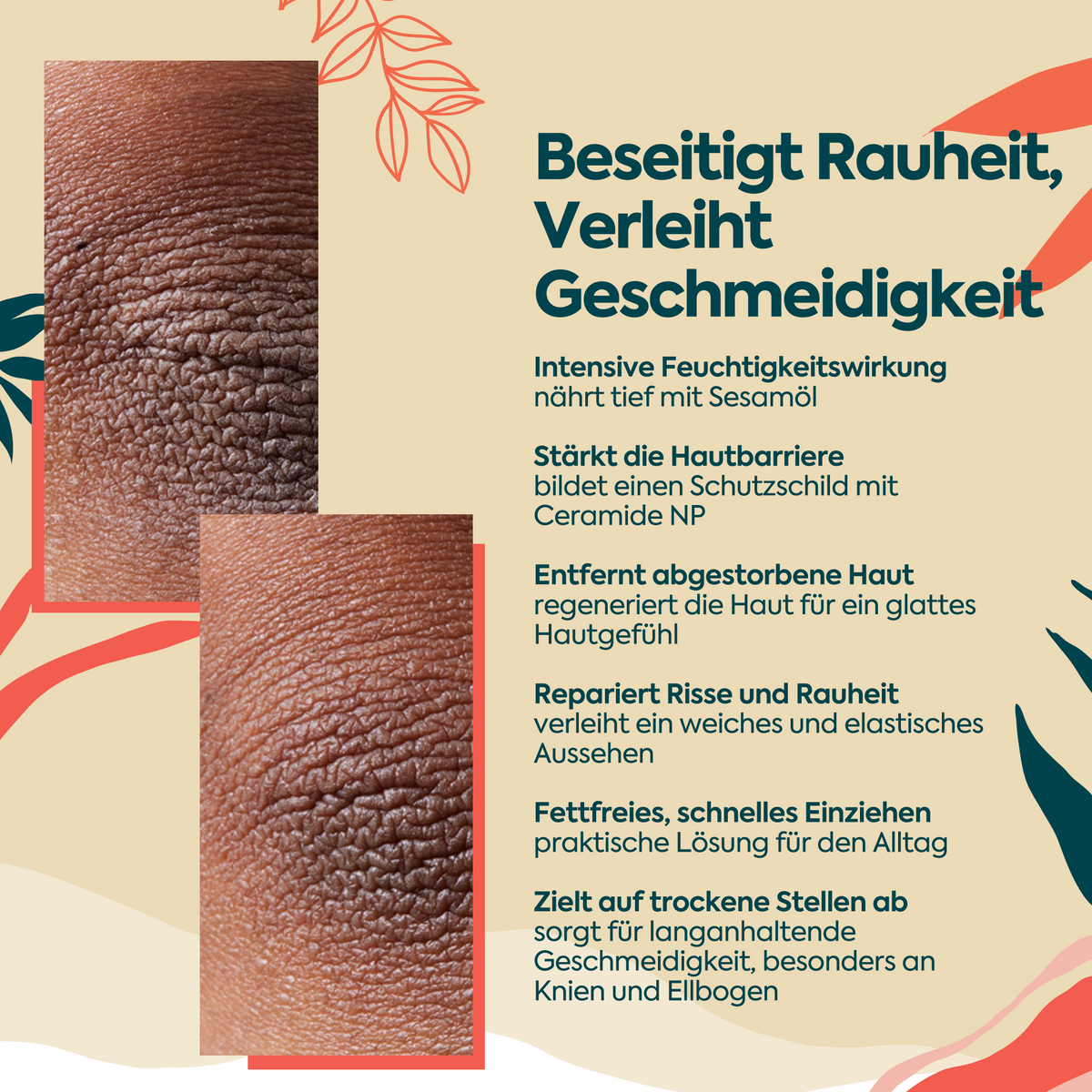 Clasy Care Pflegecreme für Ellenbogen und Knie, 100 ml