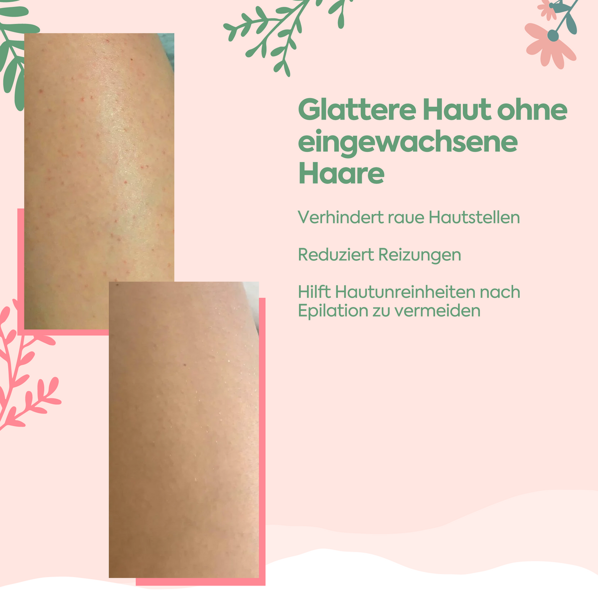 Clasy Care Haarreduzierende Pflege nach der Epilation – Bye-Bye Hairs 100 ml