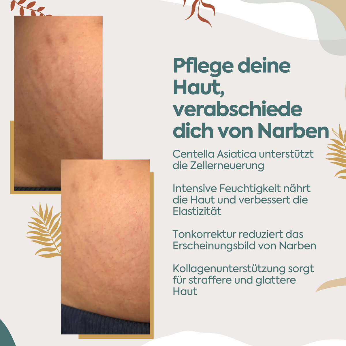 Clasy Care Perfekte Regeneration gegen Narben & Dehnungsstreifen – 100 ml