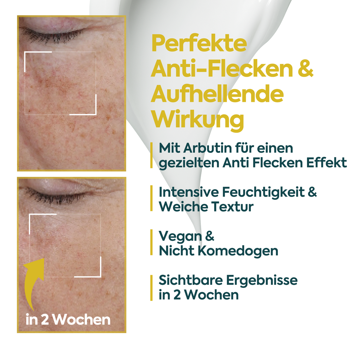 Clasy Care Aufhellende Anti-Flecken-Creme – FACEUPSKIN® Spot Cream 40 ml
