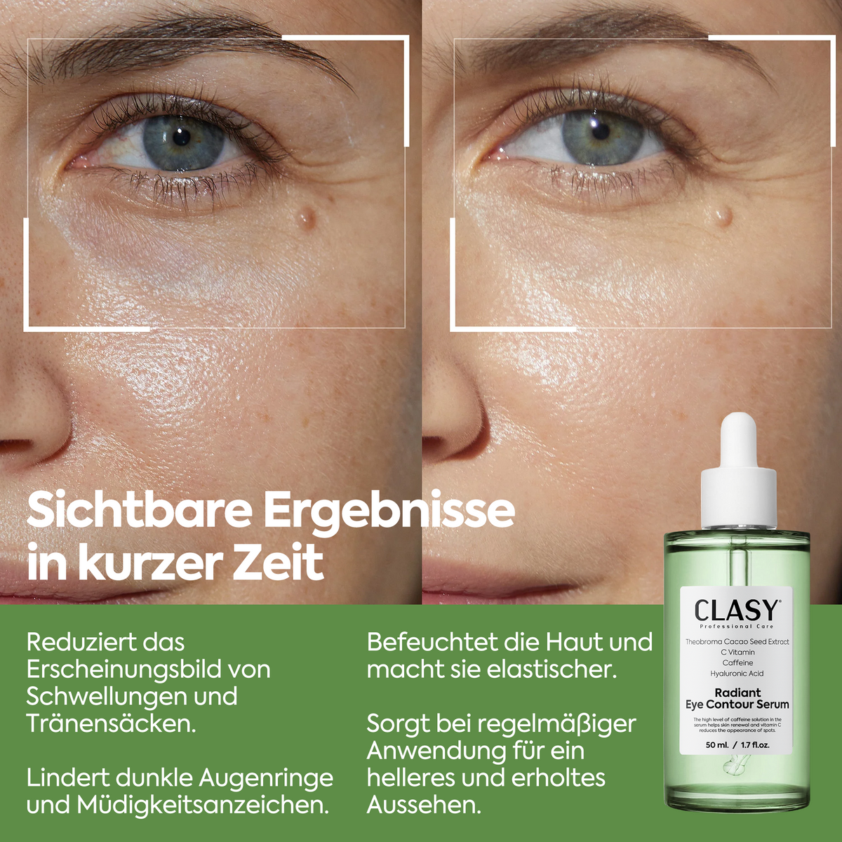 Clasy Care Augenkontur-Serum gegen Tränensäcke – Radiant Eye Contour Serum 50ml