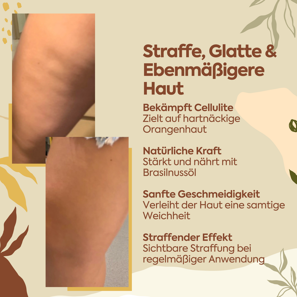 Clasy Care Perfekter Schutz gegen Cellulite – 100 ml