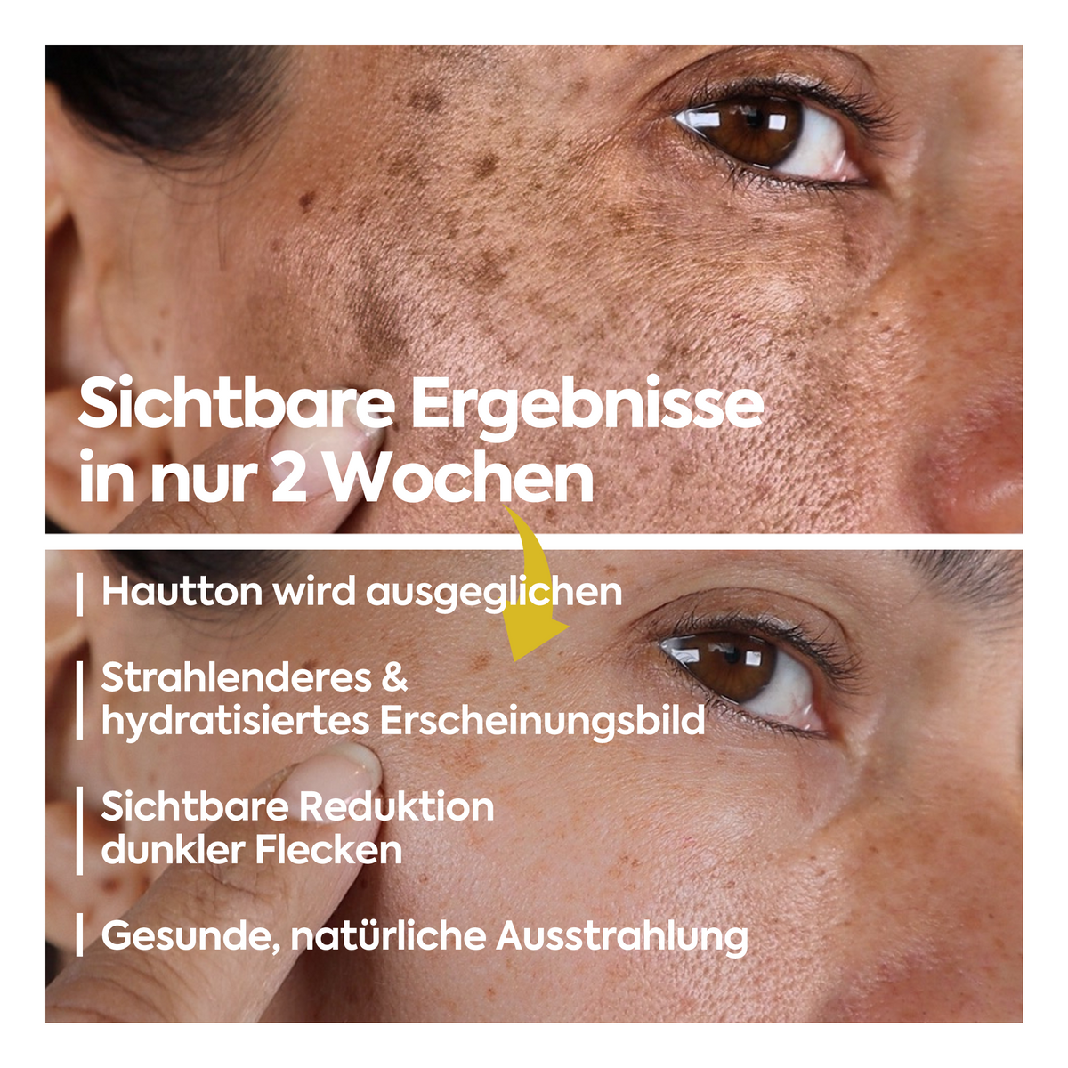 Clasy Care Aufhellende Anti-Flecken-Creme – FACEUPSKIN® Spot Cream 40 ml