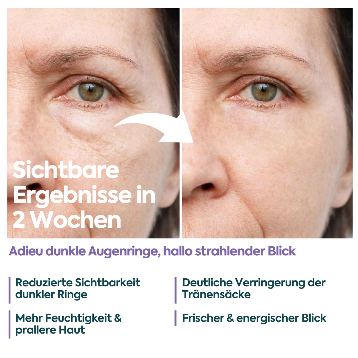Clasy Care Augencreme gegen Tränensäcke & Augenringe – FACEUPSKIN® Energy & Hydration 40 ml