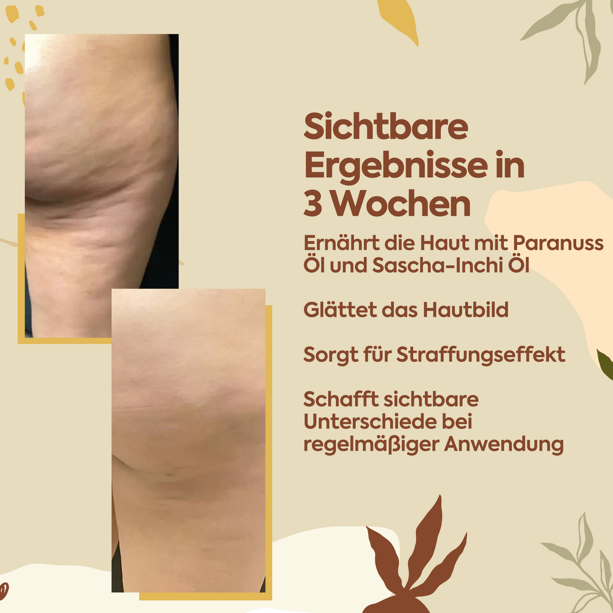 Clasy Care Perfekter Schutz gegen Cellulite – 100 ml