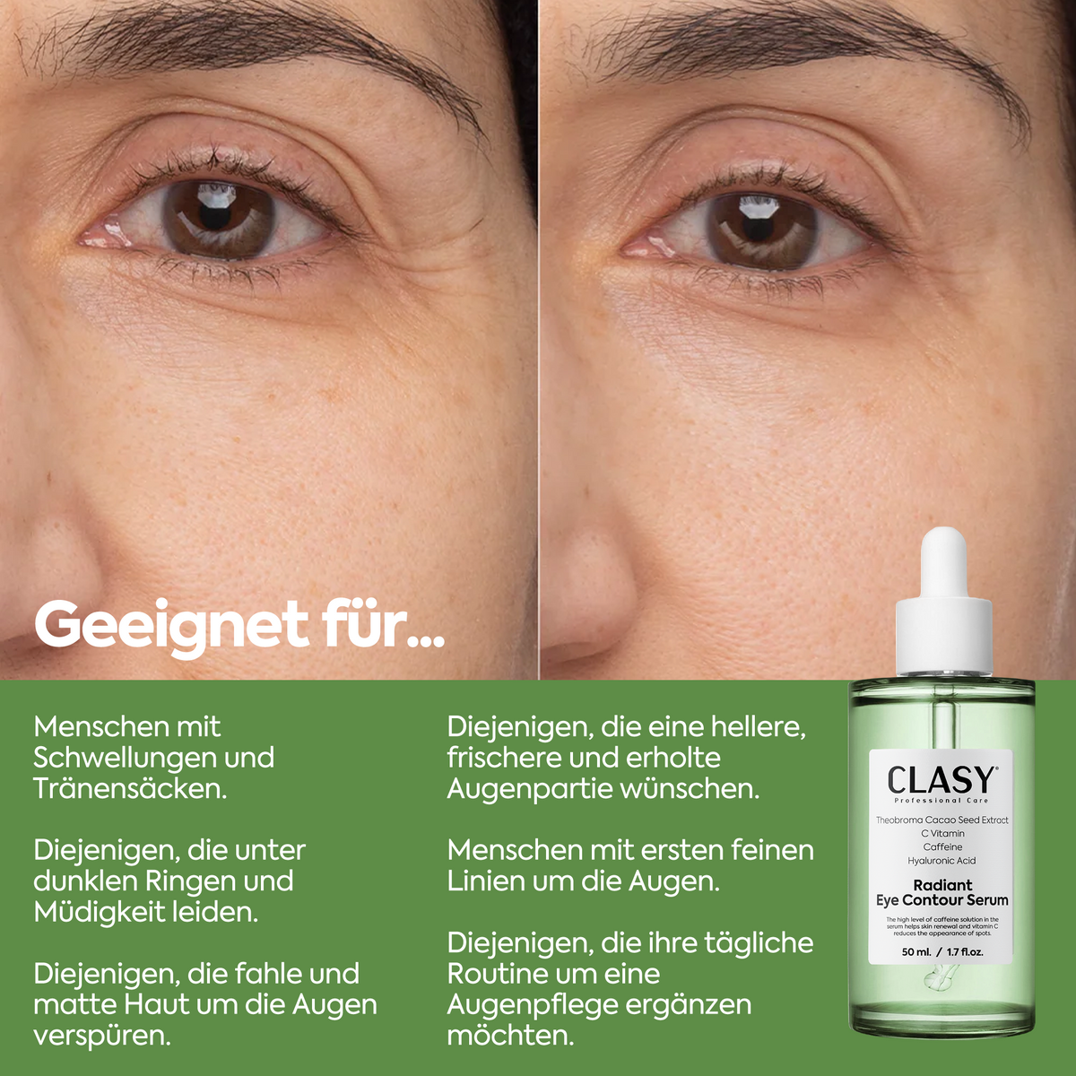 Clasy Care Augenkontur-Serum gegen Tränensäcke – Radiant Eye Contour Serum 50ml