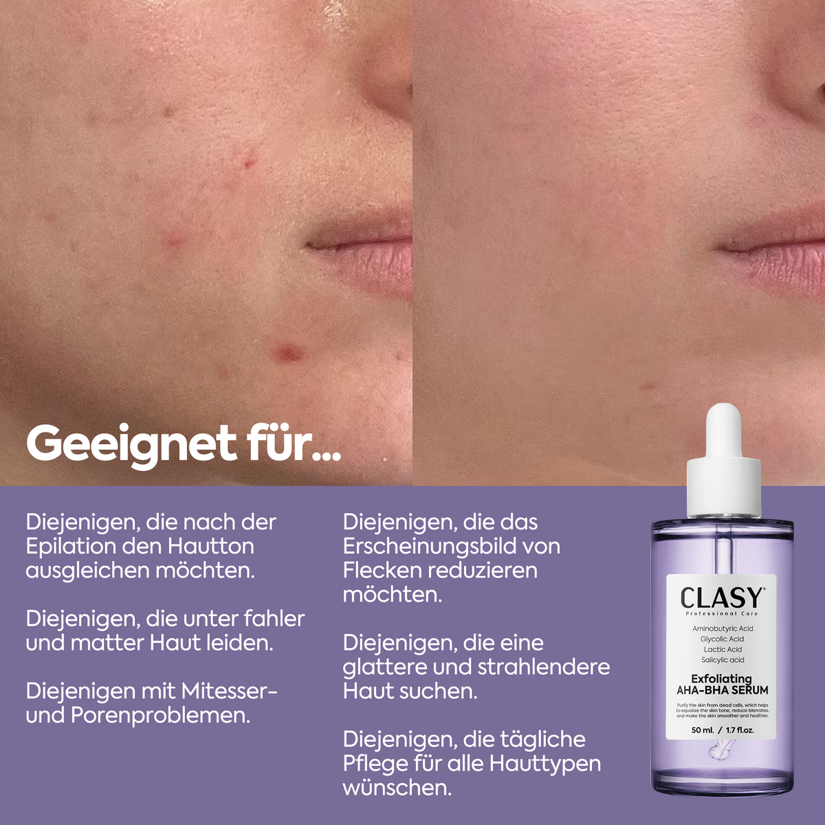 Clasy Care Hautton-ausgleichendes Peeling – Exfoliating AHA-BHA Serum 50 ml