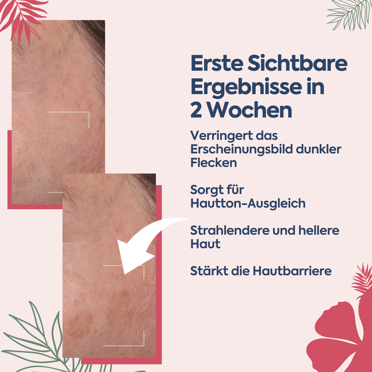 Clasy Care Anti-Flecken & Hautton-Ausgleichende Albanische Formel – Pigment Korrektur Creme 100 ml