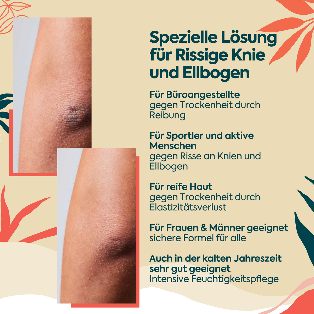 Clasy Care Pflegecreme für Ellenbogen und Knie, 100 ml