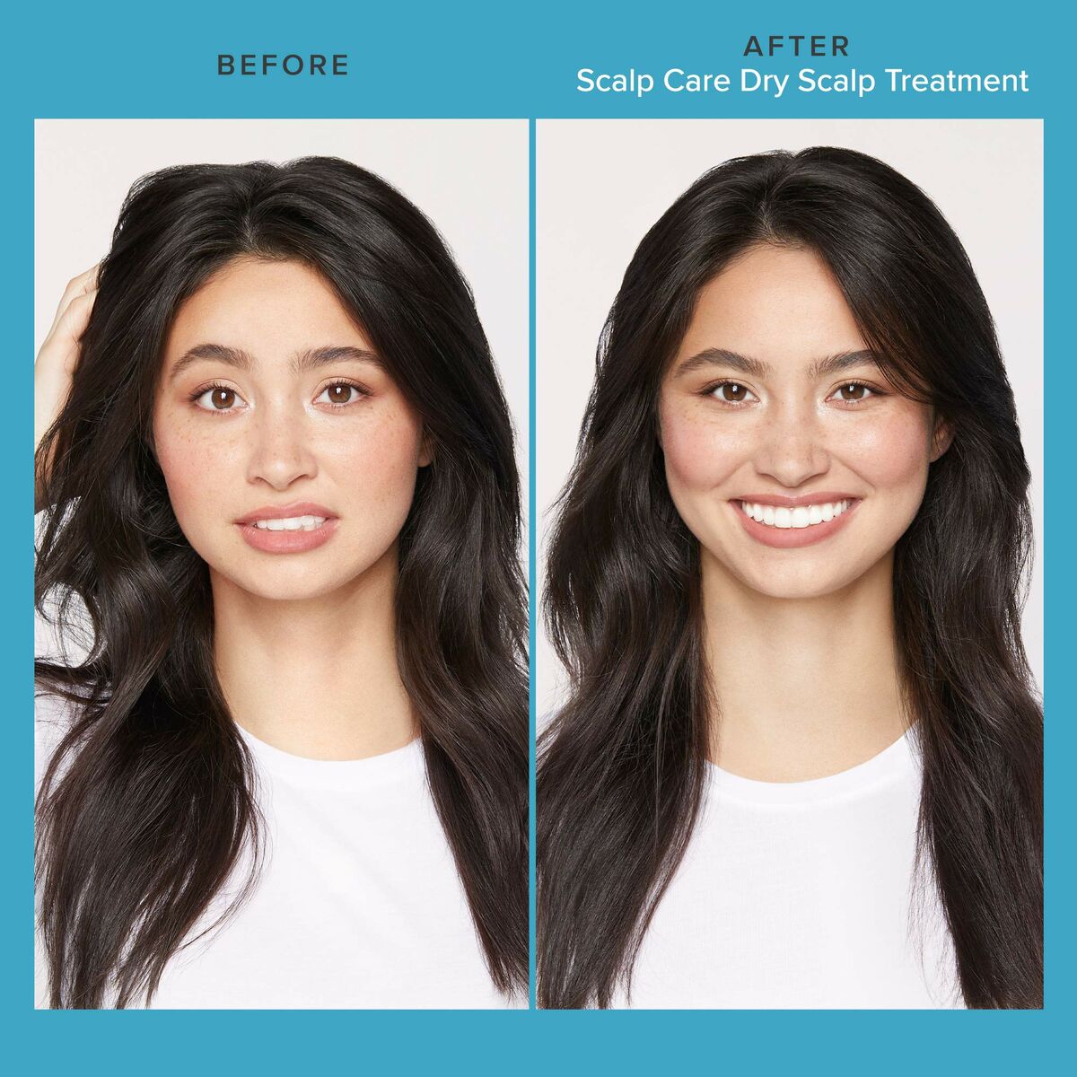 Living Proof Scalp Care Produktbild